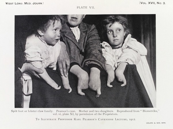 Darwinism, medical progress and eugenics : the Cavendish lecture, 1912 an address to the medical profession / by Karl Pearson.