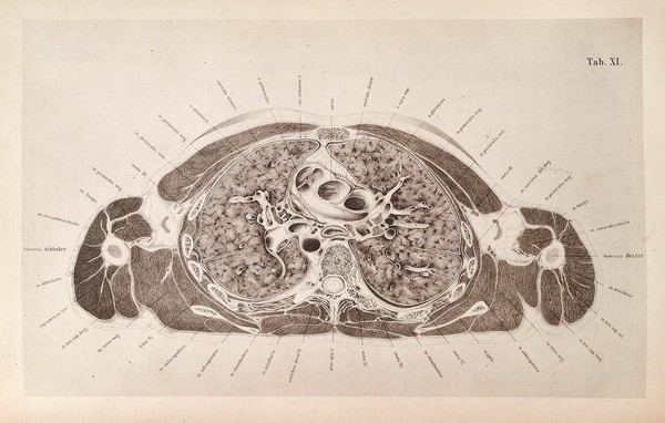 An atlas of topographical anatomy : after plane sections of frozen bodies / by Wilhelm Braune ; translated by Edward Bellamy.