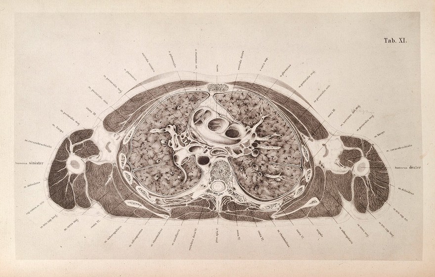 An atlas of topographical anatomy : after plane sections of frozen bodies / by Wilhelm Braune ; translated by Edward Bellamy.