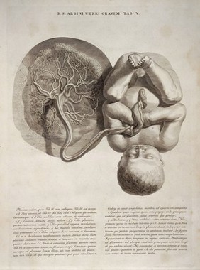 Tab V, fetus with umbilical cord and placenta