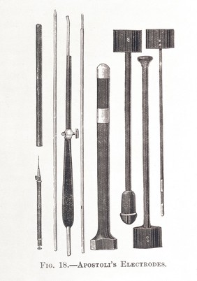 Apostoli's Electrodes used to apply elecrtical current, faradic current, to a patients via an electrical vibrator, or bipolar electrodes of Apostoli.