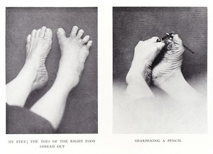 view The feet of C. H. Unthan, the armless fiddler. (R) My Feet: The toes of the right foot speard out, (L) Sharpening A Pencil