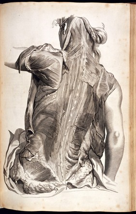 Vigesimaoctava Tablua. Engraving of a flayed female back showing the Longissimus and Deltoid muscles