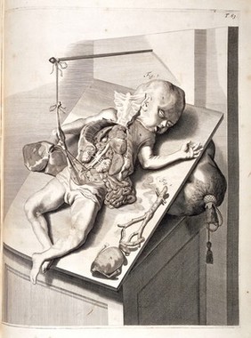 Sexagesimaetertiae Tabulae. Engraving of a baby showing its internal organs