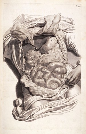 view Trigesimatertia Tabula Engraving of a flayed body showing the intestines