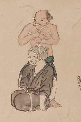 A chiropractor treating a patient. Taken from a emakimonos, or horizontal scroll, in the Shijo style.