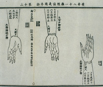 Cun, guan, chi pulses, 15th century Chinese woodcut