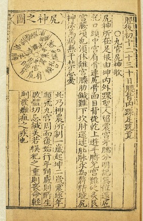 Acupuncture prohibitions, Chinese woodcut, Ming period