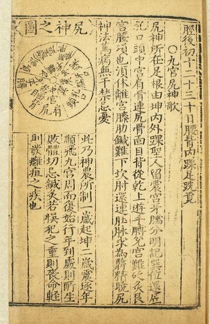 view Acupuncture prohibitions, Chinese woodcut, Ming period