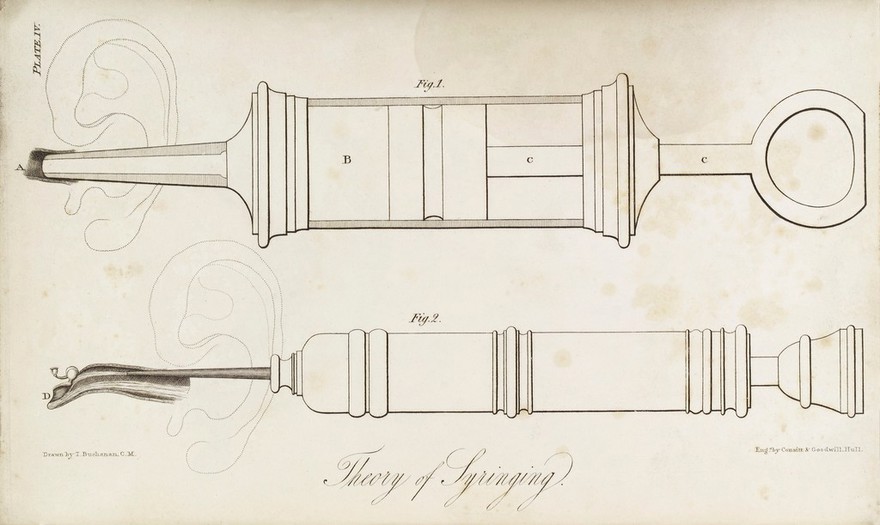 Illustrations of acoustic surgery / By Thomas Buchanan.