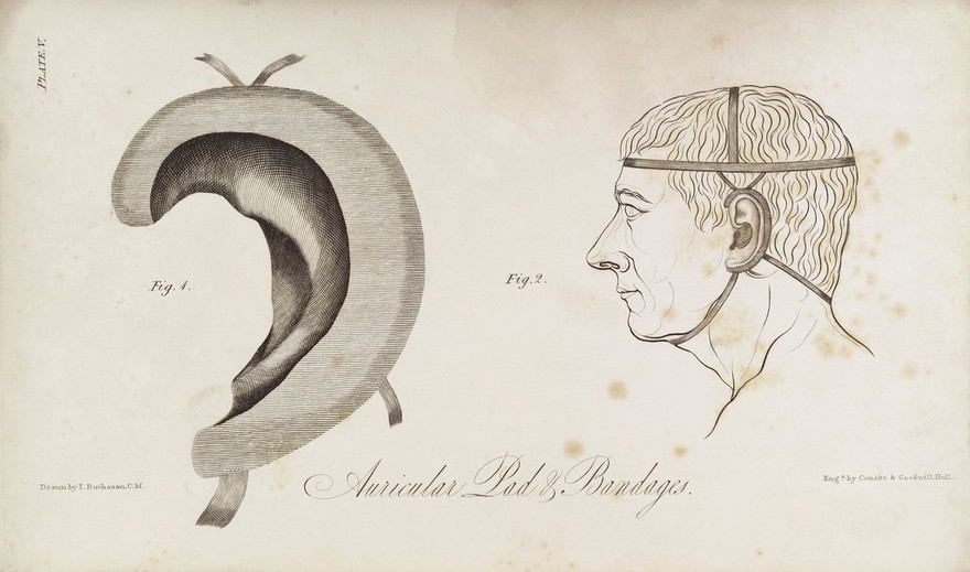 Illustrations of acoustic surgery / By Thomas Buchanan.