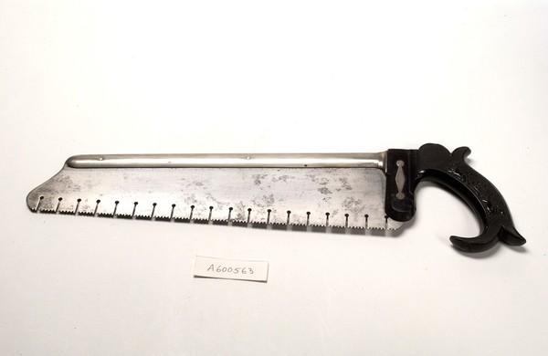 British amputation saw produced by John Weiss. The deep notches on this saw were designed to prevent bone and tissue clogging the blade.