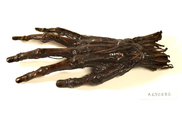 A human hand anatomised and preserved for teaching.