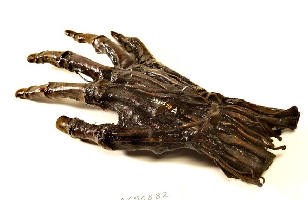 A human hand anatomised and preserved for teaching.