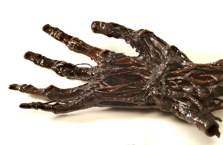 A human hand anatomised and preserved for teaching.
