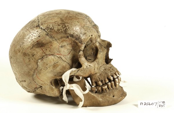 Human skull inscribed for phrenological demonstration. One half accords with Gall's theories, the other, Spurzheim's. Probably of French origin.