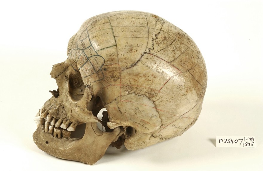 Human skull inscribed for phrenological demonstration. One half accords with Gall's theories, the other, Spurzheim's. Probably of French origin.