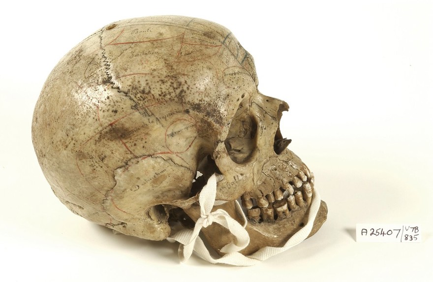Human skull inscribed for phrenological demonstration. One half accords with Gall's theories, the other, Spurzheim's. Probably of French origin.