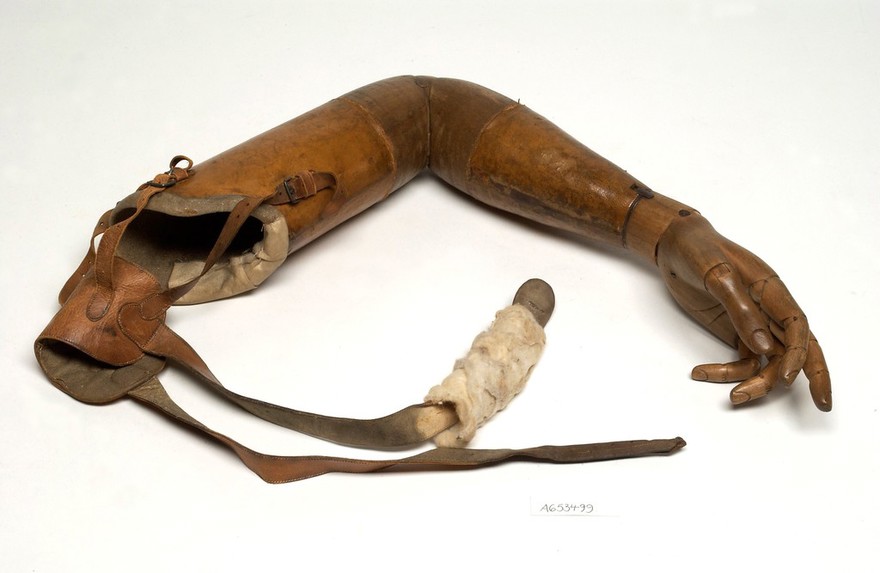 Artificial left arm and hand