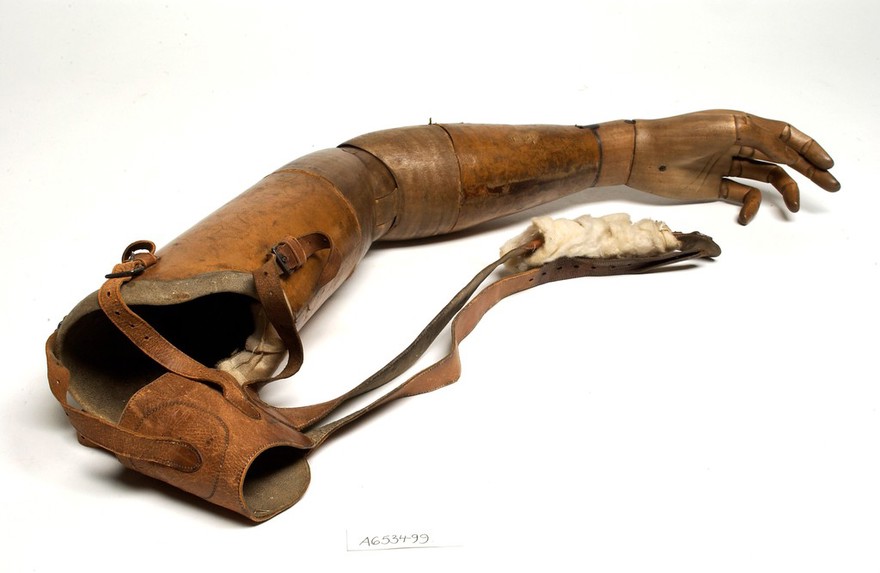 Artificial left arm and hand