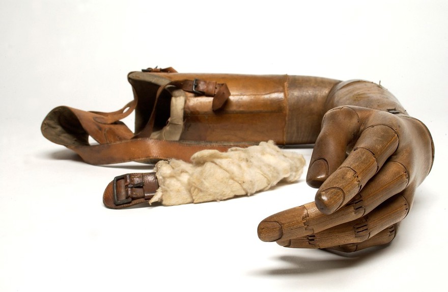 Artificial left arm and hand