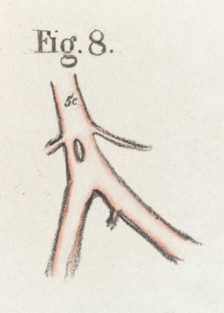 The anatomy of the arteries of the human body and its applications to pathology and operative surgery with a series of lithographic drawings / / by Richard Quain. The drawings from nature and on stone by Joseph Maclise.