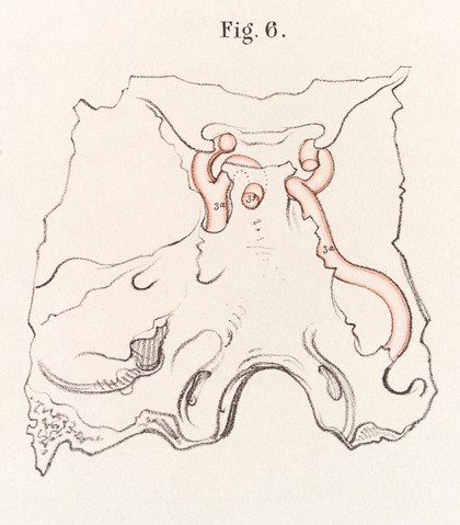 The anatomy of the arteries of the human body and its applications to pathology and operative surgery with a series of lithographic drawings / / by Richard Quain. The drawings from nature and on stone by Joseph Maclise.