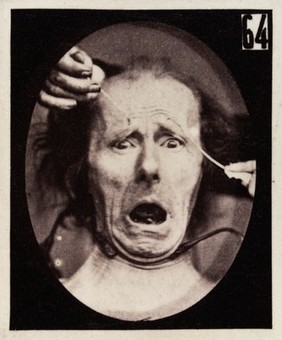 Mécanisme de la physionomie humaine, ou, Analyse électro-physiologique de l'expression des passions / [Guillaume Benjamin Amand Duchenne].