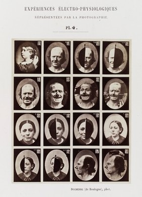 Mécanisme de la physionomie humaine, ou, Analyse électro-physiologique de l'expression des passions / [Guillaume Benjamin Amand Duchenne].