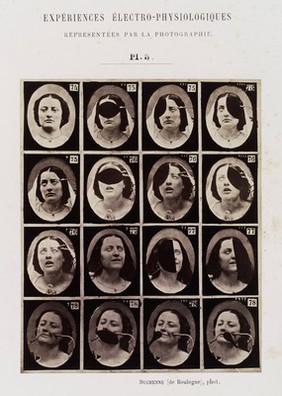 Mécanisme de la physionomie humaine, ou, Analyse électro-physiologique de l'expression des passions / [Guillaume Benjamin Amand Duchenne].