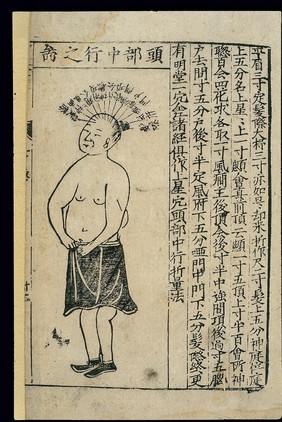 Acupuncture chart: midline of the head, Chinese woodcut