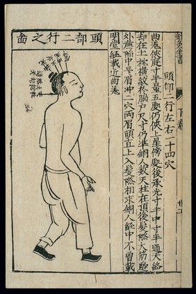 Acupuncture chart: the second head line, Chinese woodcut
