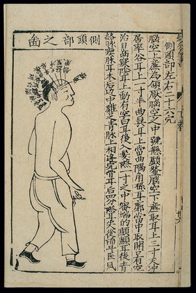 Acupuncture chart: side of the head, Chinese woodcut