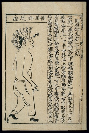 view Acupuncture chart: side of the head, Chinese woodcut