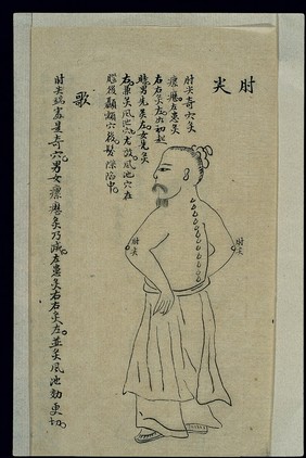 Moxibustion chart: the zhoujian points, ink drawing, Chinese