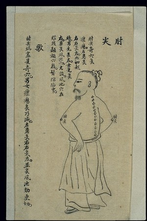 view Moxibustion chart: the zhoujian points, ink drawing, Chinese