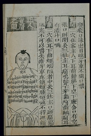 view Acu-moxa chart, front of thorax, Chinese woodcut