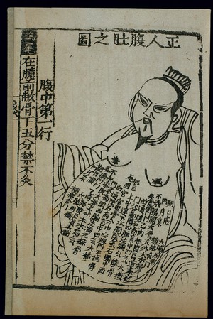 view Acu-moxa chart, front of abdomen, Chinese woodcut