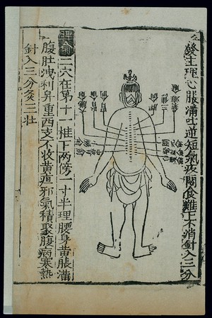 view Acu-moxa chart, back of the prone figure, Chinese woodcut