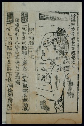 Acu-moxa chart, side of head and neck, Chinese woodcut