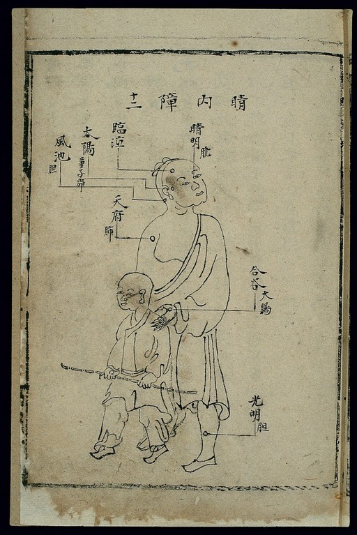 Acu-moxa chart: ophthalmology, Chinese MS