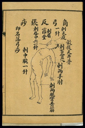 view Treatment of acute pathologies, opisthotonos, lithograph