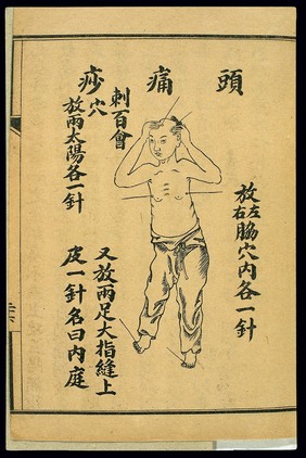 Treatment of acute pathologies, head pain, Chinese lithograph