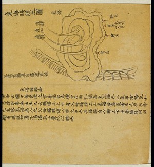 view Anatomical drawing: Sea of Qi and diaphragm, Chinese MS