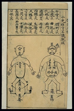 Acu-moxa chart: Infantile convulsions, Chinese MS, c. 1911