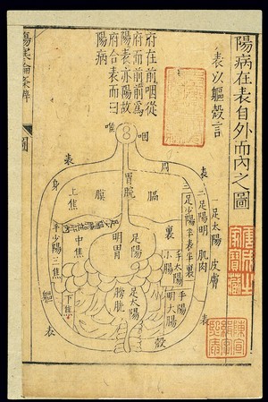 view Transmission of disease through the 3 Yang channels, Chinese