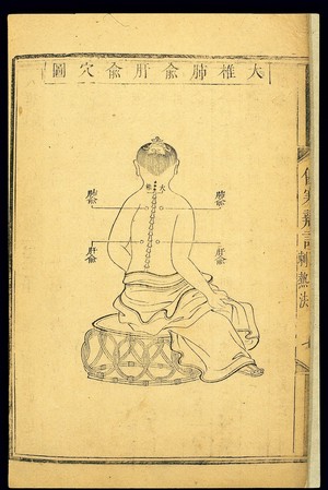 view Acumoxa chart: Location of dazhui, feishu and ganshu points