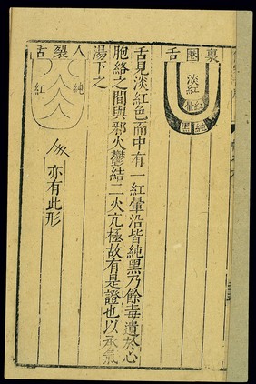 Tongue diagnosis chart, Chinese woodut, late Ming