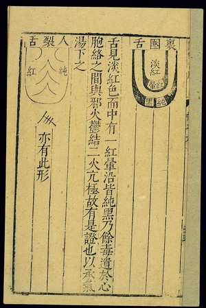 view Tongue diagnosis chart, Chinese woodut, late Ming