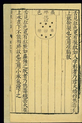 Tongue diagnosis chart, Chinese woodcut, late Ming